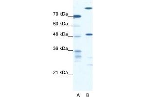 WB Suggested Anti-NFS1 Antibody Titration:  0.
