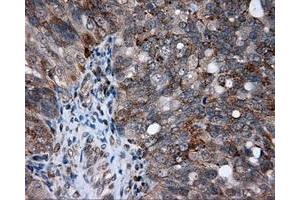 Immunohistochemical staining of paraffin-embedded Kidney tissue using anti-AKR1A1 mouse monoclonal antibody. (AKR1A1 抗体)