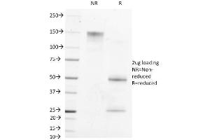 SDS-PAGE Analysis Purified AFP Mouse Monoclonal Antibody (MBS-12). (alpha Fetoprotein 抗体)