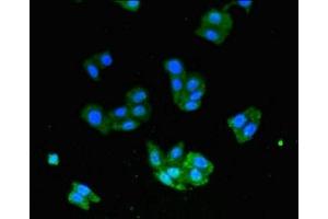 Immunofluorescent analysis of HepG2 cells using ABIN7174316 at dilution of 1:100 and Alexa Fluor 488-congugated AffiniPure Goat Anti-Rabbit IgG(H+L)