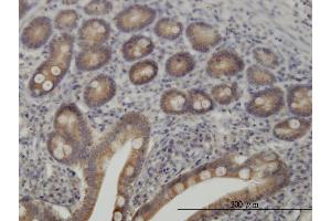 Immunoperoxidase of monoclonal antibody to TYK2 on formalin-fixed paraffin-embedded human small Intestine. (TYK2 抗体  (AA 276-375))
