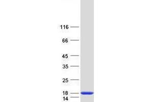 Validation with Western Blot
