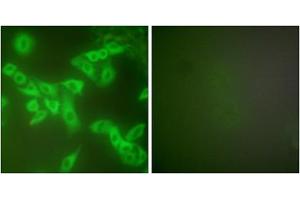 Immunofluorescence analysis of A549 cells, using Stefin B antibody (ABIN5976509). (CSTB 抗体  (Internal Region))