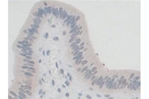 Immunohistochemistry (IHC) image for anti-G-Elongation Factor, Mitochondrial 1 (GFM1) (AA 511-751) antibody (ABIN7444172)