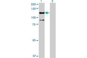Western Blotting (WB) image for anti-serine/threonine Kinase 31 (STK31) (AA 920-1020) antibody (ABIN961237) (STK31 抗体  (AA 920-1020))