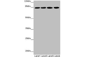 Western blot All lanes: LRSAM1 antibody at 2. (LRSAM1 抗体  (AA 1-290))