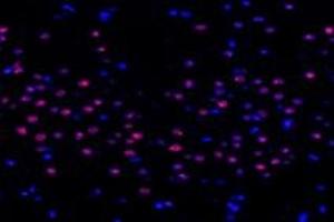 Immunofluorescent analysis of paraformaldehyde-fixed rat striatum using,TCOF1 (ABIN7076003) at dilution of 1: 1400 (TCOF1 抗体)