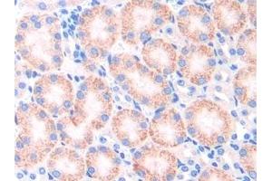 Immunohistochemistry (IHC) image for anti-Cytochrome P450, Family 21, Subfamily A, Polypeptide 2 (CYP21A2) (AA 37-264) antibody (ABIN7441889)