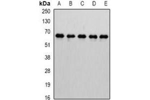 Western blot analysis of MTGR1 expression in Jurkat (A), HepG2 (B), mouse testis (C), mouse kidney (D), rat brain (E) whole cell lysates. (CBFA2T2 抗体)