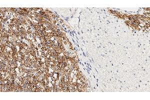 Immunohistochemistry (IHC) image for anti-Anoctamin 1, Calcium Activated Chloride Channel (ANO1) (C-Term), (Cytoplasmic Domain) antibody (ABIN7538876)