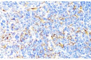 Immunohistochemistry of paraffin-embedded Mouse spleen using ITGAX Polyclonal Antibody at dilution of 1:100 (40x lens). (CD11c 抗体)