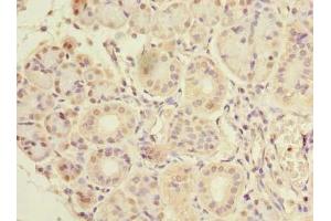 Immunohistochemistry of paraffin-embedded human pancreatic tissue using ABIN7147772 at dilution of 1:100 (CCDC108 抗体  (AA 2-164))