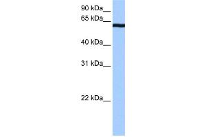 Western Blotting (WB) image for anti-Cleavage Stimulation Factor, 3' Pre-RNA, Subunit 2, 64kDa, tau Variant (CSTF2T) (C-Term) antibody (ABIN2779081)