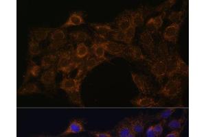 Immunofluorescence analysis of C6 cells using FoxO3a Polyclonal Antibody at dilution of 1:100. (FOXO3 抗体)