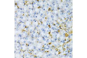 Immunohistochemistry of paraffin-embedded mouse kidney using TAPBP Antibody (ABIN1875423) at dilution of 1:200 (40x lens). (TAPBP 抗体)