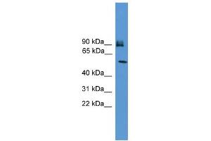 WB Suggested Anti-OSBPL11 Antibody Titration:  0. (OSBPL11 抗体  (C-Term))