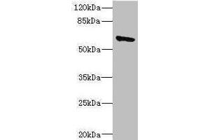 Western blot All lanes: SOCS5 antibody IgG at 1. (SOCS5 抗体  (AA 1-270))