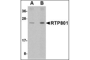 Western blot analysis of RTP801 in human kidney tissue lysate with this product at (A) 0.