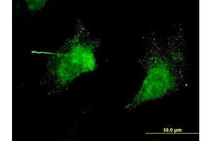 Immunofluorescence of monoclonal antibody to KCNC3 on NIH/3T3 cell.