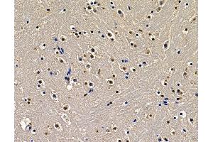 ABIN7097120 and ABIN7101188 at 1/100 staining mouse brain tissue by IHC-P. (ZNF233 抗体)