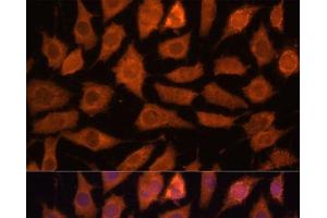 Immunofluorescence analysis of L929 cells using LGMN Polyclonal Antibody at dilution of 1:100 (40x lens).