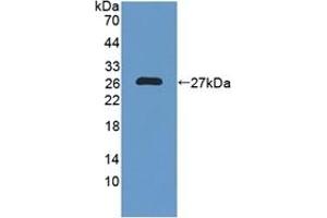 Detection of Recombinant NXN, Human using Polyclonal Antibody to Nucleoredoxin (NXN) (NXN 抗体  (AA 166-327))