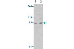 Western blot analysis of human heart tissue with LZTR1 polyclonal antibody  at (Lane 1) 1 and (Lane 2) 2 ug/mL dilution. (LZTR1 抗体  (N-Term))