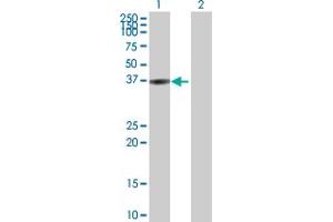 Western Blot analysis of BLVRA expression in transfected 293T cell line by BLVRA MaxPab polyclonal antibody. (Biliverdin Reductase 抗体  (AA 1-296))