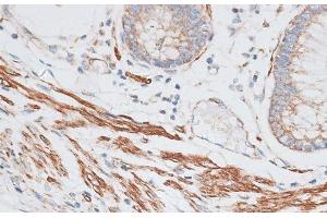Immunohistochemistry (Paraffin-embedded Sections) (IHC (p)) image for anti-G Protein-Coupled Receptor Kinase 5 (GRK5) antibody (ABIN7260899)
