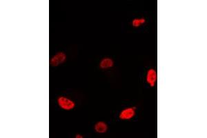 Immunofluorescent analysis of c-Myc staining in Jurkat cells. (c-MYC 抗体  (C-Term))