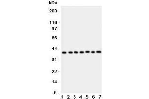Western blot testing of ARA9 antibody and Lane 1:  HeLa;  2: COLO320;  3: HT1080;  4: MCF-7;  5: SW620;  6: U87;  7: MM231;  Predicted/Observed size: 37KD (AIP 抗体  (AA 91-330))