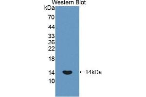 Detection of Recombinant PLOD1, Human using Polyclonal Antibody to Procollagen Lysine-1,2-Oxoglutarate-5-Dioxygenase 1 (PLOD1) (PLOD1 抗体  (AA 636-727))