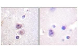Immunohistochemistry (IHC) image for anti-Mitogen-Activated Protein Kinase 14 (MAPK14) antibody (ABIN1847989) (MAPK14 抗体)