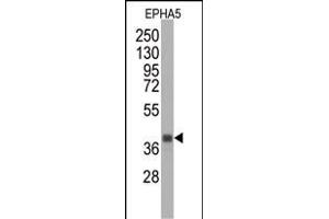 Western blot analysis of anti-EPHA5 Monoclonal Antibody (ABIN387809 and ABIN2843902) by EPHA5 recombinant protein (Fragment). (EPH Receptor A5 抗体)