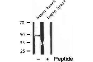 Western blot analysis of extracts of human heart tissue, using ATPB antibody. (ATP5B 抗体  (Internal Region))