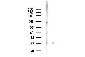 anti-Nuclear Receptor Interacting Protein 3 (NRIP3) (C-Term) antibody