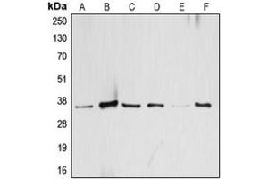 Western blot analysis of ATF1 expression in HeLa (A), KNRK (B), A431 (C), SP2/0 (D), mouse brain (E), H9C2 (F) whole cell lysates.