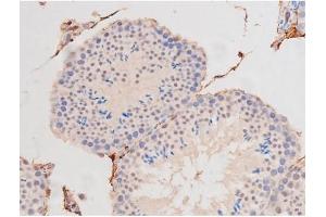 Immunohistochemistry (IHC) image for anti-Mast/stem Cell Growth Factor Receptor (KIT) (pTyr703) antibody (ABIN6255994)