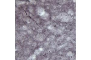 IHC on rat brain (free floating sections) using Rabbit antibody to VGluT1  at a concentration of 30 µg/ml. (SLC17A7 抗体)