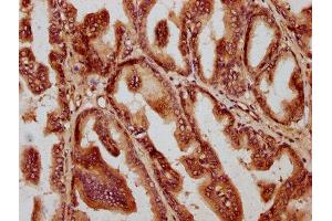 IHC image of ABIN7160302 diluted at 1:1400 and staining in paraffin-embedded human prostate tissue performed on a Leica BondTM system. (AMH 抗体  (AA 26-560))