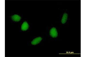 Immunofluorescence of purified MaxPab antibody to NUDT6 on HepG2 cell. (NUDT6 抗体  (AA 1-316))