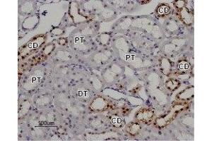 Immunohistochemistry (IHC) image for anti-Transient Receptor Potential Cation Channel, Subfamily V, Member 5 (TRPV5) (AA 715-729), (Intracellular) antibody (ABIN7043855)