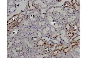Expression of TRPV5 in rat kidney - Immunohistochemical staining of rat kidney paraffin embedded section using Anti-TRPV5 Antibody (ABIN7043855, ABIN7043996 and ABIN7043997), (1:100). (TRPV5 抗体  (C-Term, Intracellular))