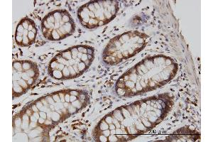 Immunoperoxidase of monoclonal antibody to RGL1 on formalin-fixed paraffin-embedded human colon. (RGL1 抗体  (AA 2-109))