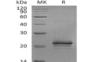 Western Blotting (WB) image for Vascular Endothelial Growth Factor A (VEGFA) protein (ABIN7321249) (VEGFA 蛋白)