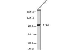 Western blot analysis of extracts of Mouse testis, using STK39 Rabbit mAb (ABIN1682890, ABIN3015922, ABIN3015923 and ABIN7101461) at 1:1000 dilution. (STK39 抗体)