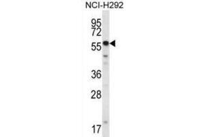 Western Blotting (WB) image for anti-SET and MYND Domain Containing 2a (SMYD2A) antibody (ABIN2995651) (SMYD2A 抗体)