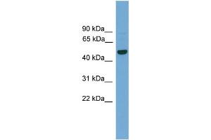 WB Suggested Anti-GRAMD3  Antibody Titration: 0. (GRAMD3 抗体  (Middle Region))