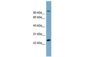 SEMA3D antibody used at 1 ug/ml to detect target protein. (SEMA3D 抗体  (Middle Region))