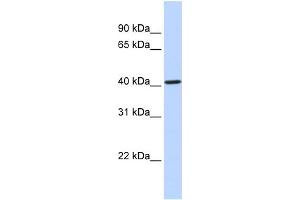 WB Suggested Anti-CYP4F12 Antibody Titration:  0.